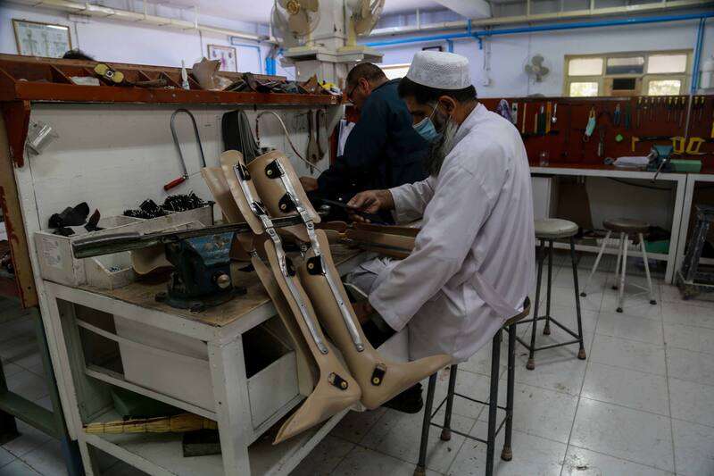 Indian doctors provide free prosthetic limbs to 100 Afghans in Kabul, restoring hope and mobility.
