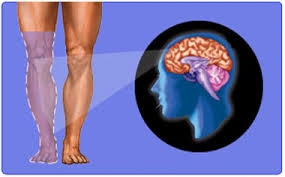 Brain-generated pain in phantom limb shown via medical illustration.