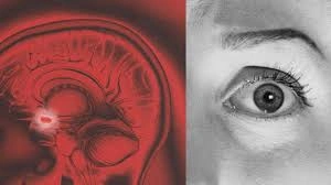 Brain graphic: Amygdala processes emotions before cortex.